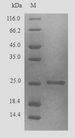 Glutathione S-Transferase Protein - (Tris-Glycine gel) Discontinuous SDS-PAGE (reduced) with 5% enrichment gel and 15% separation gel.