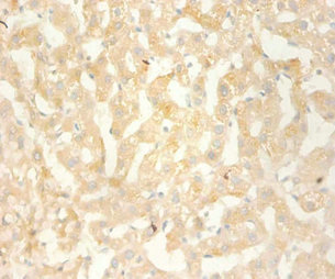 BLC / CXCL13 Antibody - Immunohistochemistry of paraffin-embedded human liver tissue using CXCL13 Antibody at dilution of 1:100