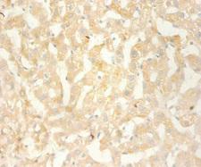 BLC / CXCL13 Antibody - Immunohistochemistry of paraffin-embedded human liver tissue using CXCL13 Antibody at dilution of 1:100