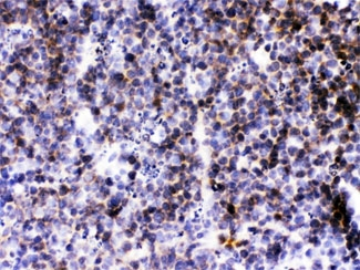 BLC / CXCL13 Antibody - IHC testing of FFPE mouse lymph tissue with BCA1 antibody at 1ug/ml. HIER: steam sections in pH6 citrate buffer for 20 min.