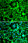 BLID Antibody - Immunofluorescence analysis of MCF7 cells.