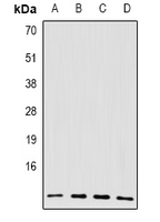 BLID Antibody - Western blot analysis of BRCC2 expression in A549 (A); SKOV3 (B); mouse spleen (C); rat spleen (D) whole cell lysates.