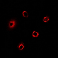 BLID Antibody - Immunofluorescent analysis of BRCC2 staining in MCF7 cells. Formalin-fixed cells were permeabilized with 0.1% Triton X-100 in TBS for 5-10 minutes and blocked with 3% BSA-PBS for 30 minutes at room temperature. Cells were probed with the primary antibody in 3% BSA-PBS and incubated overnight at 4 deg C in a humidified chamber. Cells were washed with PBST and incubated with a DyLight 594-conjugated secondary antibody (red) in PBS at room temperature in the dark.