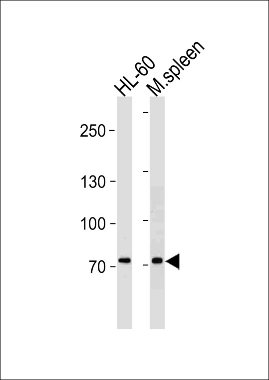 BLIMP1 / PRDM1 Antibody - PRDM1 Antibody western blot of HL-60 cell line and mouse spleen tissue lysates (35 ug/lane). The PRDM1 antibody detected the PRDM1 protein (arrow).