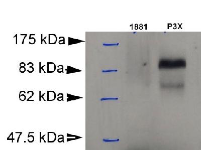 BLIMP1 / PRDM1 Antibody - Detection of Blimp-1 in murine plasmacytoma cell lysate (P3X). 1881: murine pre-B cell lysate (negative control).  This image was taken for the unconjugated form of this product. Other forms have not been tested.
