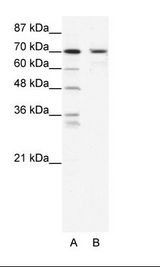 BLIMP1 / PRDM1 Antibody - A: Marker, B: HepG2 Cell Lysate.  This image was taken for the unconjugated form of this product. Other forms have not been tested.