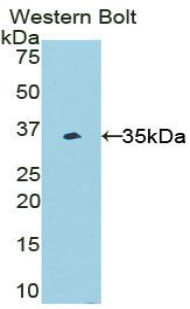 BLIMP1 / PRDM1 Antibody - Western blot of recombinant BLIMP1 / PRDM1.  This image was taken for the unconjugated form of this product. Other forms have not been tested.
