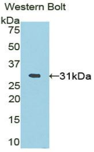 BLIMP1 / PRDM1 Antibody - Western blot of recombinant BLIMP1 / PRDM1.  This image was taken for the unconjugated form of this product. Other forms have not been tested.