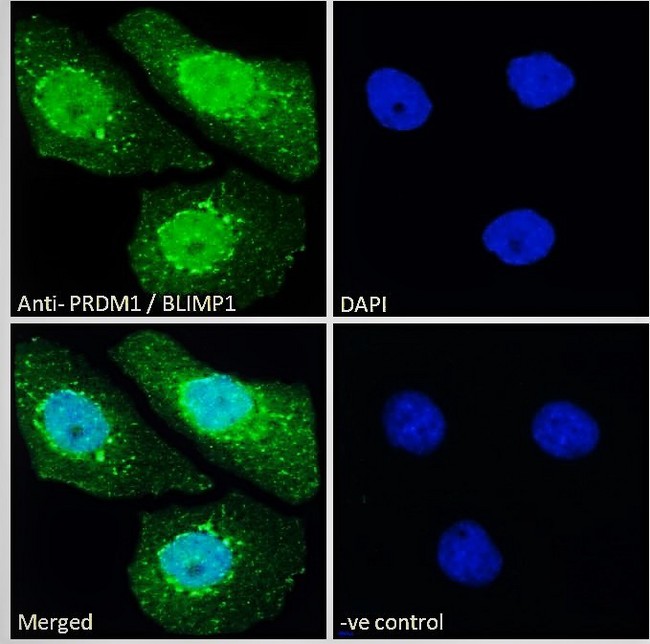 BLIMP1 / PRDM1 Antibody - Goat Anti-PRDM1 / BLIMP1 Antibody Immunofluorescence analysis of paraformaldehyde fixed A431 cells, permeabilized with 0.15% Triton. Primary incubation 1hr (10ug/ml) followed by Alexa Fluor 488 secondary antibody (2ug/ml), showing nuclear staining. The nuclear stain is DAPI (blue). Negative control: Unimmunized goat IgG (10ug/ml) followed by Alexa Fluor 488 secondary antibody (2ug/ml).