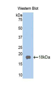 BLIMP1 / PRDM1 Antibody - Western blot of recombinant BLIMP1 / PRDM1.  This image was taken for the unconjugated form of this product. Other forms have not been tested.