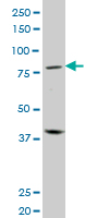 BLIMP1 / PRDM1 Antibody - PRDM1 monoclonal antibody (M01), clone 2B10. Western Blot analysis of PRDM1 expression in human spleen.