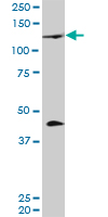 BLIMP1 / PRDM1 Antibody - PRDM1 monoclonal antibody (M01), clone 2B10. Western Blot analysis of PRDM1 expression in human tongue.