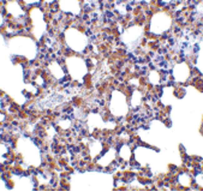 BLIMP1 / PRDM1 Antibody - Immunohistochemistry of Blimp-1 in mouse lung tissue with Blimp-1 antibody at 5 ug/ml.