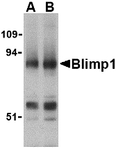 BLIMP1 / PRDM1 Antibody - Western blot of Blimp-1 in mouse lung tissue lysate with Blimp-1 antibody at (A) 0.5 and (B) 1 ug/ml.