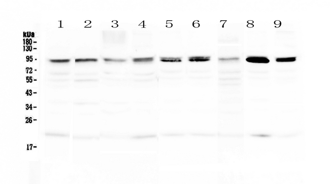BLIMP1 / PRDM1 Antibody - Western blot - Anti-PRDM1/Blimp1 Picoband antibody