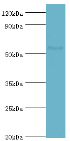BLK Antibody - Western blot. All lanes: Tyrosine-protein kinase Blk antibody at 10 ug/ml+mouse kidney tissue. Secondary antibody: Goat polyclonal to rabbit at 1:10000 dilution. Predicted band size: 58 kDa. Observed band size: 58 kDa.