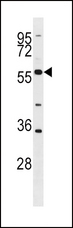 BLK Antibody - BLK Antibody (G1) western blot of HL-60 cell line lysates (35 ug/lane). The BLK antibody detected the BLK protein (arrow).