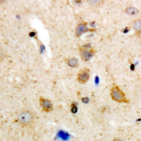 BLK Antibody - Immunohistochemical analysis of BLK staining in human brain formalin fixed paraffin embedded tissue section. The section was pre-treated using heat mediated antigen retrieval with sodium citrate buffer (pH 6.0). The section was then incubated with the antibody at room temperature and detected using an HRP polymer system. DAB was used as the chromogen. The section was then counterstained with hematoxylin and mounted with DPX.