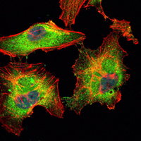 BLK Antibody - Immunofluorescence of HeLa cells using BLK mouse monoclonal antibody (green). Blue: DRAQ5 fluorescent DNA dye. Red: Actin filaments have been labeled with Alexa Fluor-555 phalloidin.