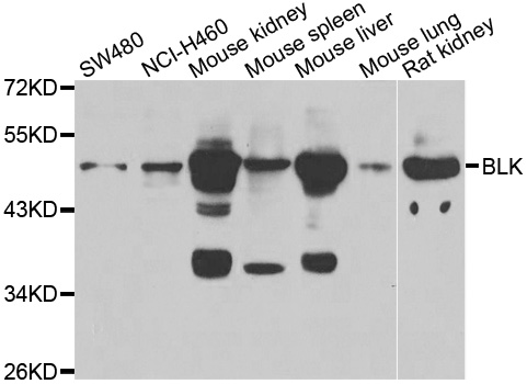 BLK Antibody - Western blot analysis of extracts of various cell lines.