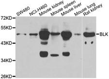 BLK Antibody - Western blot analysis of extracts of various cell lines.