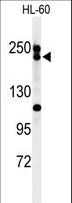 BLM Antibody - Western blot of BLM Antibody in HL-60 cell line lysates (35 ug/lane). BLM (arrow) was detected using the purified antibody.