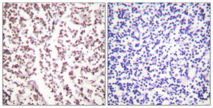 BLM Antibody - Peptide - + Immunohistochemistry analysis of paraffin-embedded human lymph node tissue using Bloom Syndrome antibody.