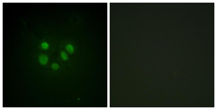 BLM Antibody - Peptide - + Immunofluorescence analysis of A549 cells, using Bloom Syndrome antibody.