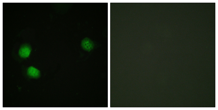 BLM Antibody - Immunofluorescence analysis of HeLa cells, using Bloom Syndrome (Phospho-Thr99) Antibody. The picture on the right is blocked with the phospho peptide.
