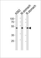 BLMH Antibody - BLMH Antibody western blot of K562 cell line, mouse stomach and rat stomach tissue lysates (35 ug/lane). The BLMH antibody detected the BLMH protein (arrow).