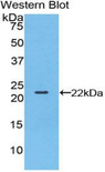 BLMH Antibody - Western blot of recombinant BLMH.  This image was taken for the unconjugated form of this product. Other forms have not been tested.