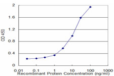 BLMH Antibody - Detection limit for recombinant GST tagged BLMH is approximately 0.3 ng/ml as a capture antibody.