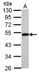 BLMH Antibody - Sample (30 ug of whole cell lysate) A: A549 10% SDS PAGE BLMH antibody diluted at 1:1000