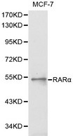 BLMH Antibody - Western blot of RAR alpha pAb in extracts from MCF7 cells.