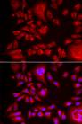 BLMH Antibody - Immunofluorescence analysis of HeLa cells.