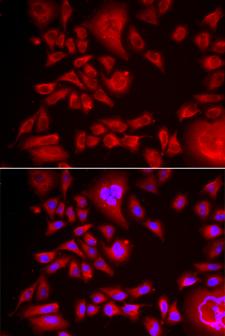 BLMH Antibody - Immunofluorescence analysis of HeLa cells.