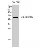 BLNK Antibody - Western blot of Phospho-BLNK (Y96) antibody