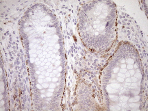 BLNK Antibody - Immunohistochemical staining of paraffin-embedded Human colon tissue within the normal limits using anti-BLNK mouse monoclonal antibody. (Heat-induced epitope retrieval by 1mM EDTA in 10mM Tris buffer. (pH8.5) at 120°C for 3 min. (1:150)