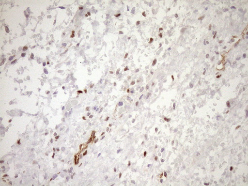 BLNK Antibody - Immunohistochemical staining of paraffin-embedded Human Ovary tissue within the normal limits using anti-BLNK mouse monoclonal antibody. (Heat-induced epitope retrieval by 1mM EDTA in 10mM Tris buffer. (pH8.5) at 120°C for 3 min. (1:150)