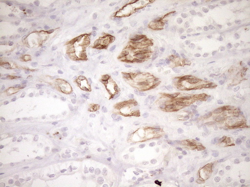 BLNK Antibody - Immunohistochemical staining of paraffin-embedded Human Kidney tissue within the normal limits using anti-BLNK mouse monoclonal antibody. (Heat-induced epitope retrieval by 1mM EDTA in 10mM Tris buffer. (pH8.5) at 120°C for 3 min. (1:150)
