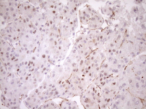 BLNK Antibody - Immunohistochemical staining of paraffin-embedded Human liver tissue within the normal limits using anti-BLNK mouse monoclonal antibody. (Heat-induced epitope retrieval by 1mM EDTA in 10mM Tris buffer. (pH8.5) at 120°C for 3 min. (1:150)