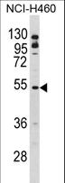 BLNK Antibody - Western blot of BLNK Antibody in NCI-H460 cell line lysates (35 ug/lane). BLNK (arrow) was detected using the purified antibody.