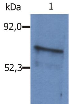 BLNK Antibody - Western Blotting analysis (reducing conditions) of whole cell lysate of Sp2/0 mouse myeloma cell line using polyclonal anti-mouse SLP65 / BLNK antibody.