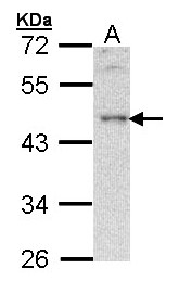 BLNK Antibody - Sample (30 ug of whole cell lysate). A: Hela. 10% SDS PAGE. BLNK antibody diluted at 1:500.
