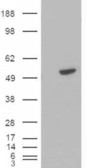 BLNK Antibody - BLNK antibody (0.3µg/ml) staining of Daudi cell lysate (35µg protein in RIPA buffer). Detected by chemiluminescence.