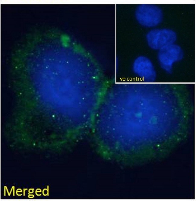 BLNK Antibody - BLNK antibody immunofluorescence analysis of paraformaldehyde fixed HepG2 cells, permeabilized with 0.15% Triton. Primary incubation 1hr (10ug/ml) followed by Alexa Fluor 488 secondary antibody (2ug/ml), showing some membrane staining. The nuclear stain is DAPI (blue). Negative control: Unimmunized goat IgG (10ug/ml) followed by Alexa Fluor 488 secondary antibody (2ug/ml).