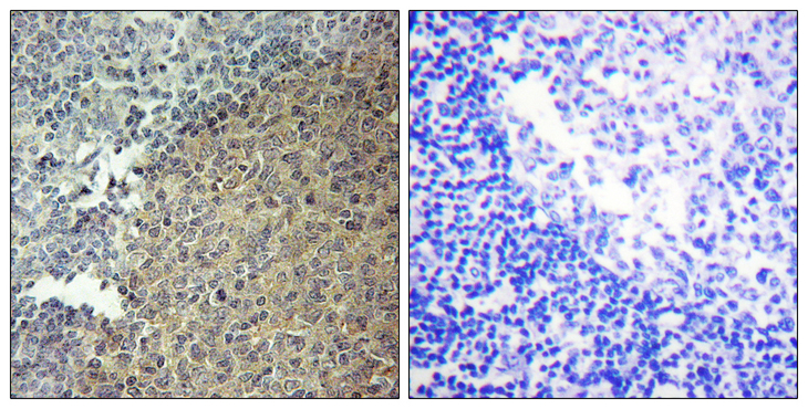 BLNK Antibody - Immunohistochemistry analysis of paraffin-embedded human tonsil tissue, using BLNK Antibody. The picture on the right is blocked with the synthesized peptide.