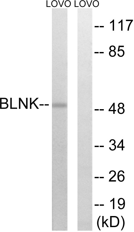 BLNK Antibody - Western blot analysis of lysates from LOVO cells, treated with etoposide 25uM 24h, using BLNK Antibody. The lane on the right is blocked with the synthesized peptide.