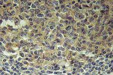 BLNK Antibody - Immunohistochemistry (IHC) analysis of BLNK (N91) pAb in paraffin-embedded human tonsil tissue.
