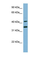 BLNK Antibody - BLNK antibody Western blot of NCI-H226 cell lysate. This image was taken for the unconjugated form of this product. Other forms have not been tested.